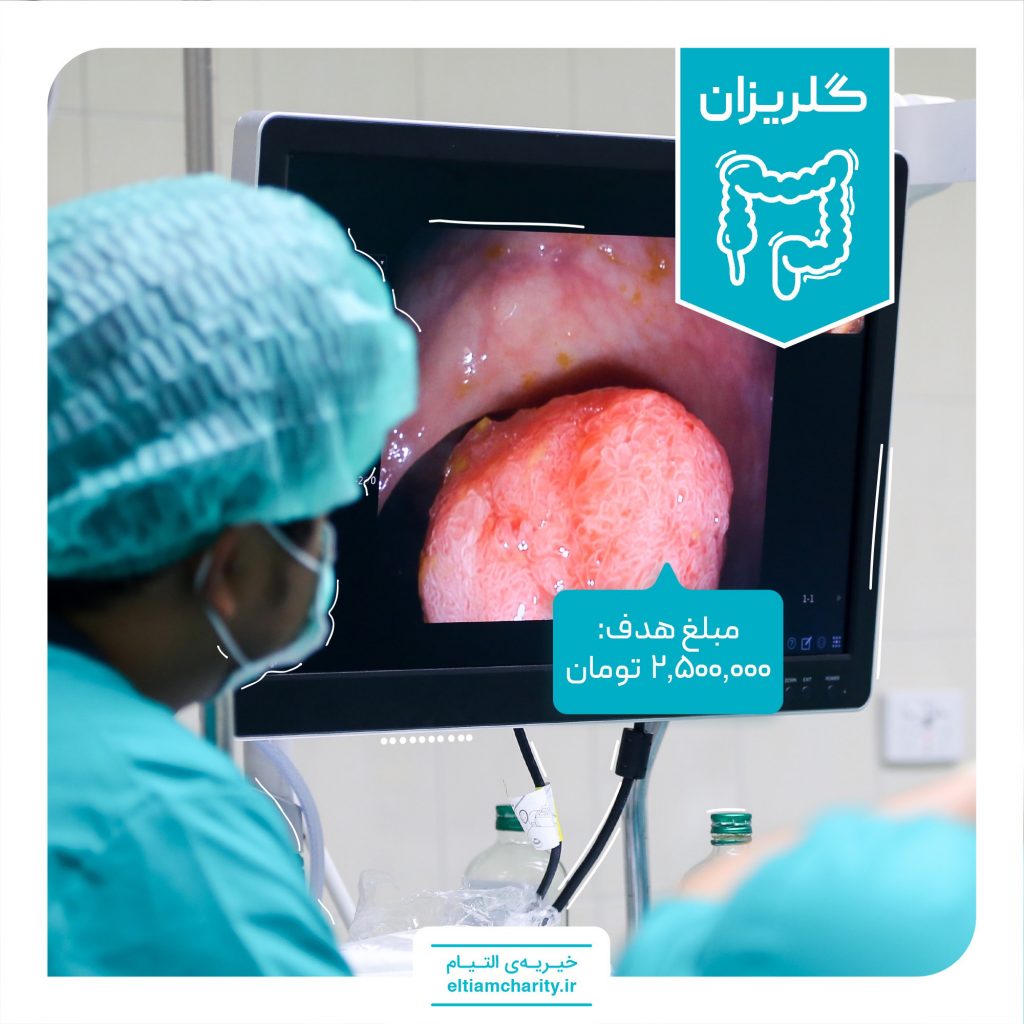 Endoscopy and colonoscopy