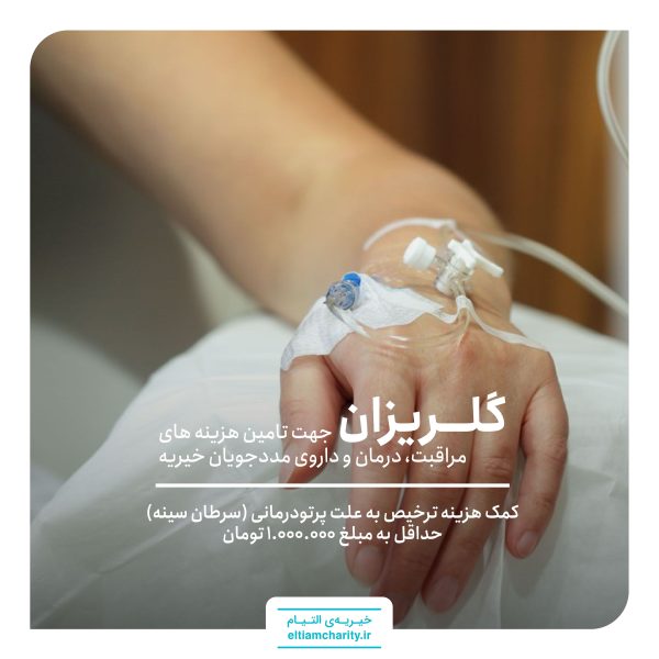 سرطان سینه