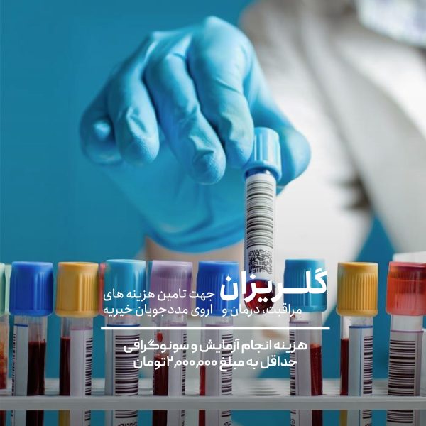 هزینه آزمایش و سونوگرافی مادر 49 ساله