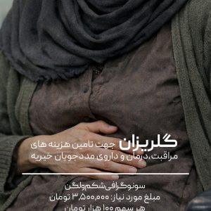 گلریزان سونوگرافی شکم و لگن